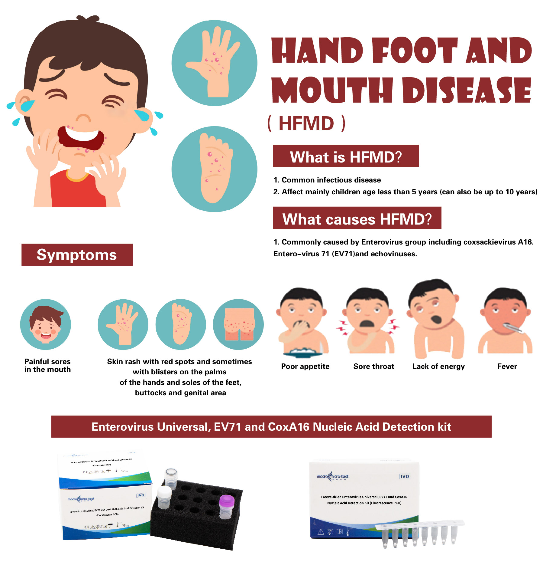 News - One test detects all pathogens causing HFMD