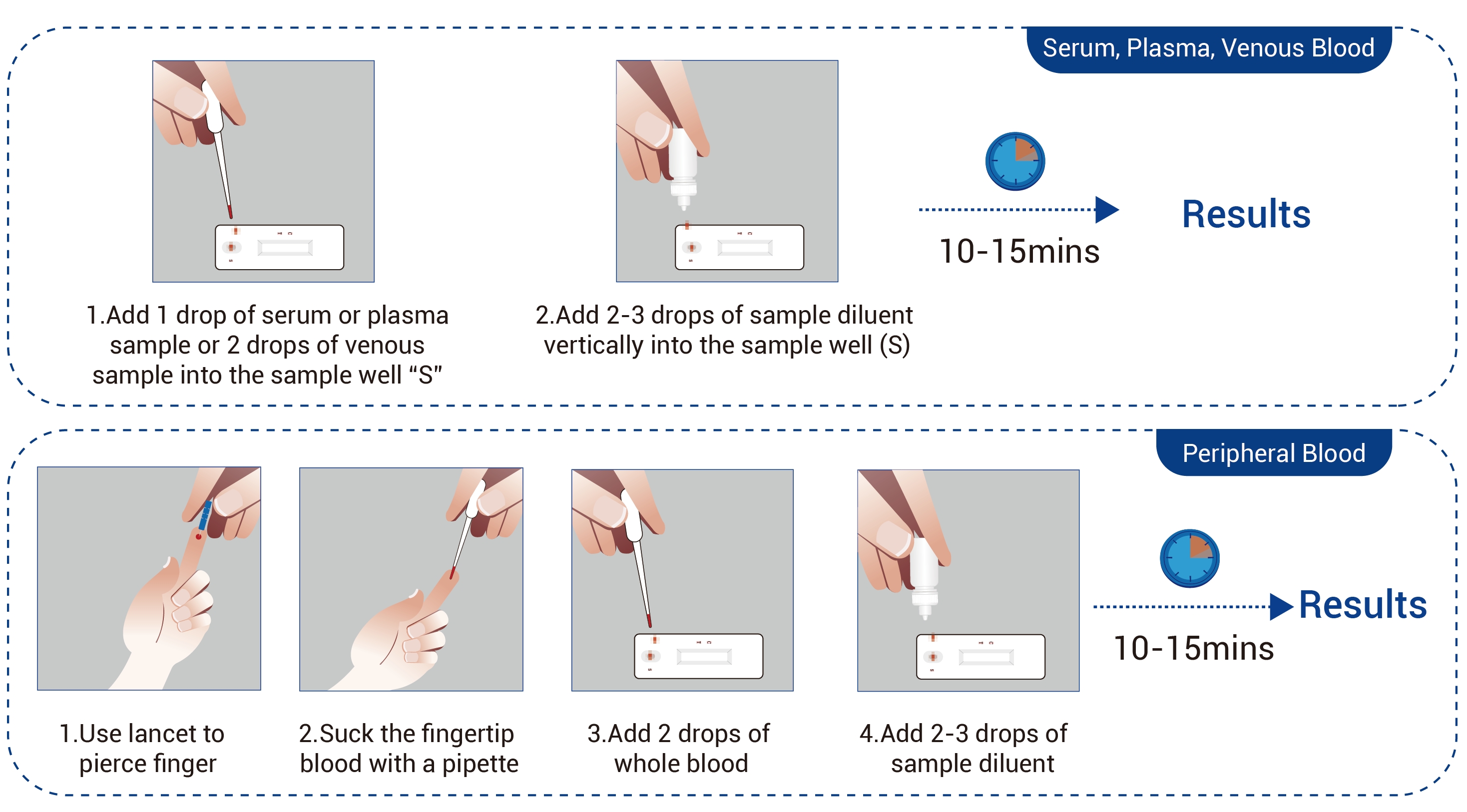 Monkeypox Virus IgM/IgG Antibody Detection Kit (Immunochromatography)